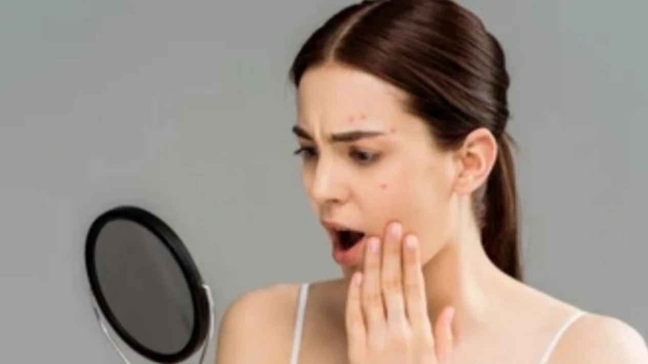 Mengapa Kulit Sensitif Butuh Pelembap Khusus untuk Skin Barrier