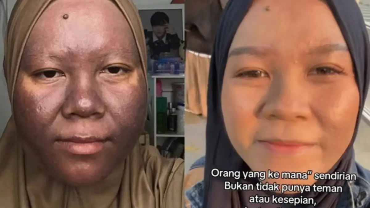 Merkuri dalam Skincare: Kulit Menggelap, Okronosis, dan Jalan Panjang Pemulihan