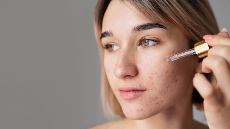 5 Serum Terbaik untuk Memperbaiki Skin Barrier