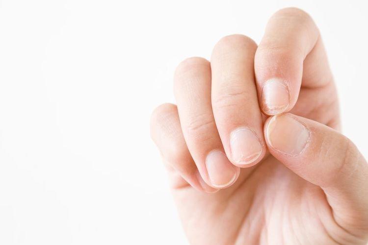 Kuku Menguning Setelah Pakai Kutek? Begini Cara Mengatasinya