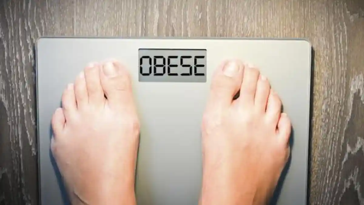 Hampir 1 dari 4 Orang Dewasa Mengalami Obesitas: Ini Penyakit Kronis, Bukan Sekadar Berat Badan