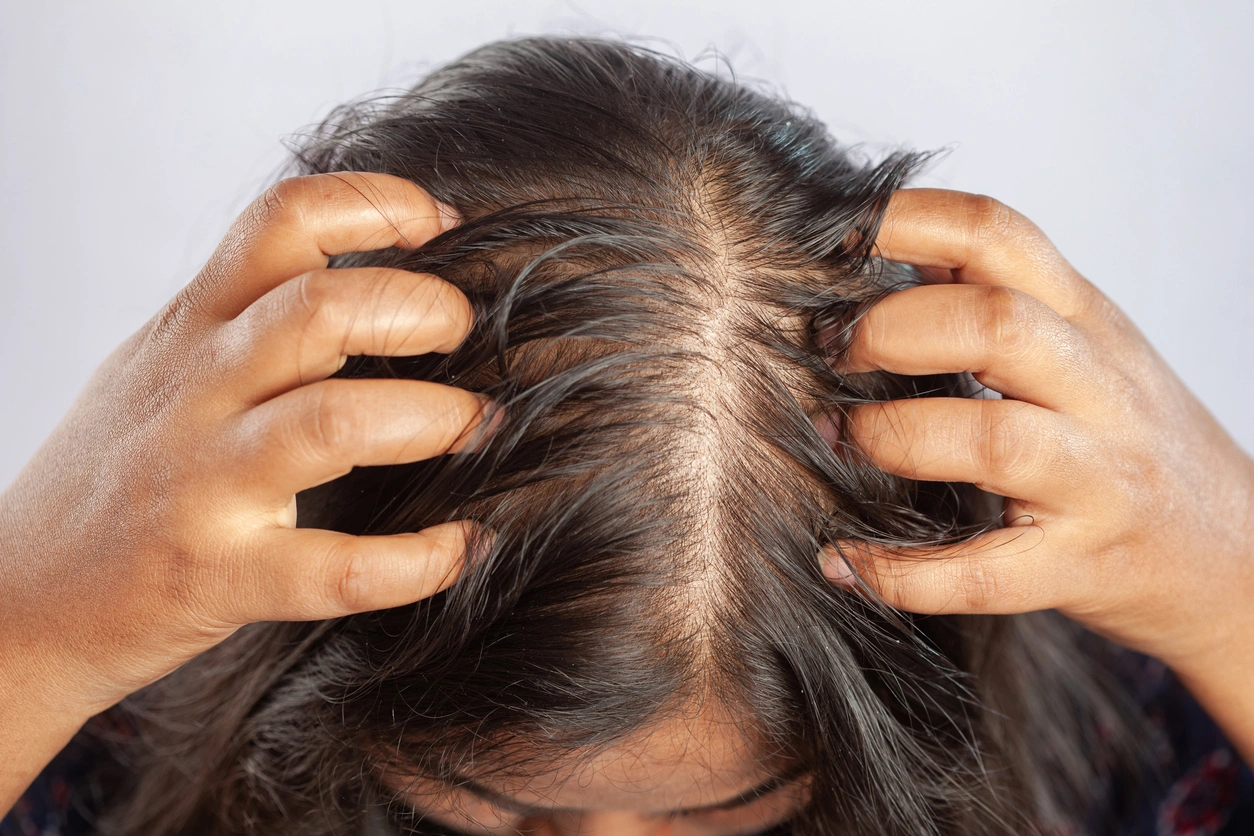 Rambut Rontok Bukan Hanya Masalah Genetik: 5 Penyebab Tersembunyi yang Sering Diabaikan