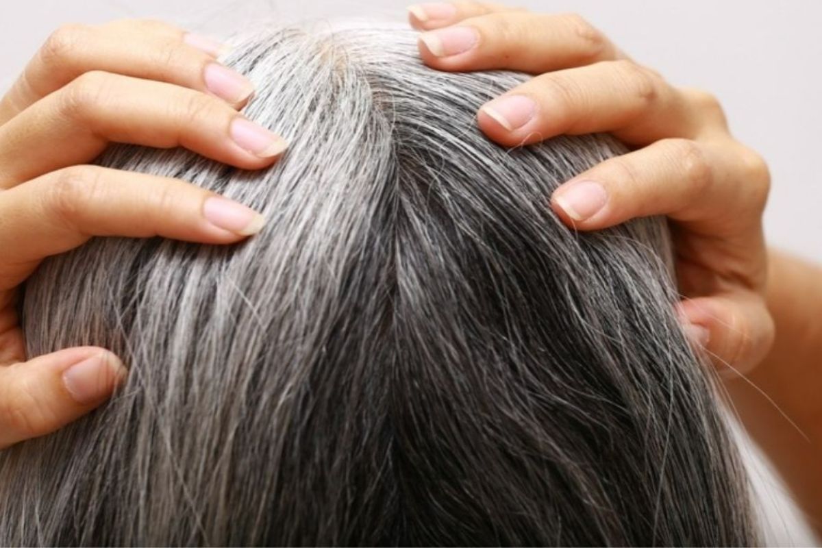 Stres Bisa Membuat Rambut Beruban, Bisakah Berbalik?