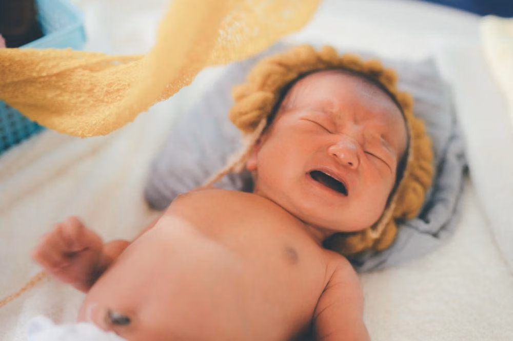 5 Cara Membedakan Bayi Kuning Normal atau Patologis