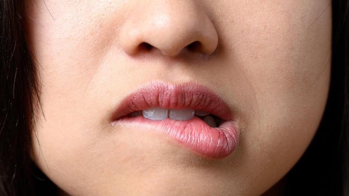 3 Bahan Alami Ampuh Atasi Bibir Kering Pecah-Pecah