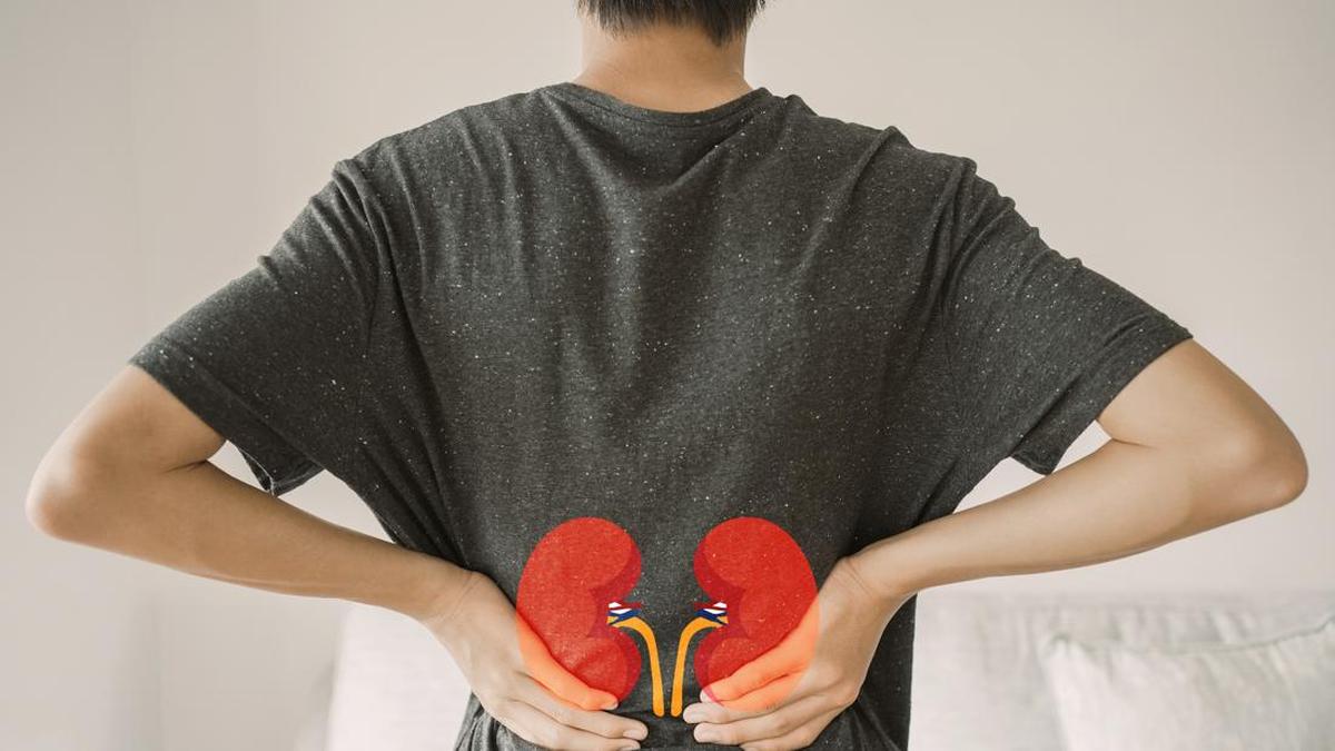 Dehidrasi Pemicu Utama Batu Ginjal dan Cara Dokter Mencegah Kambuh