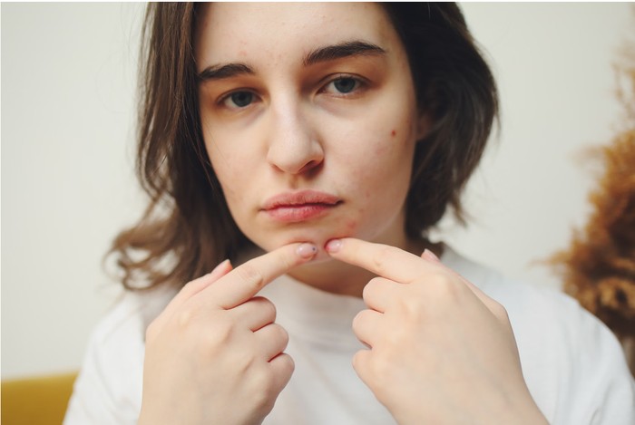 6 Kebiasaan Cuci Muka yang Merusak Kulit dan Cara Memperbaikinya