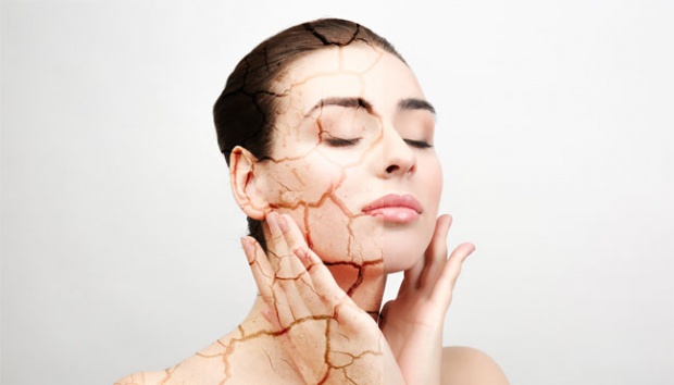 4 Kandungan Skincare yang Wajib Dihindari Penderita Eksim