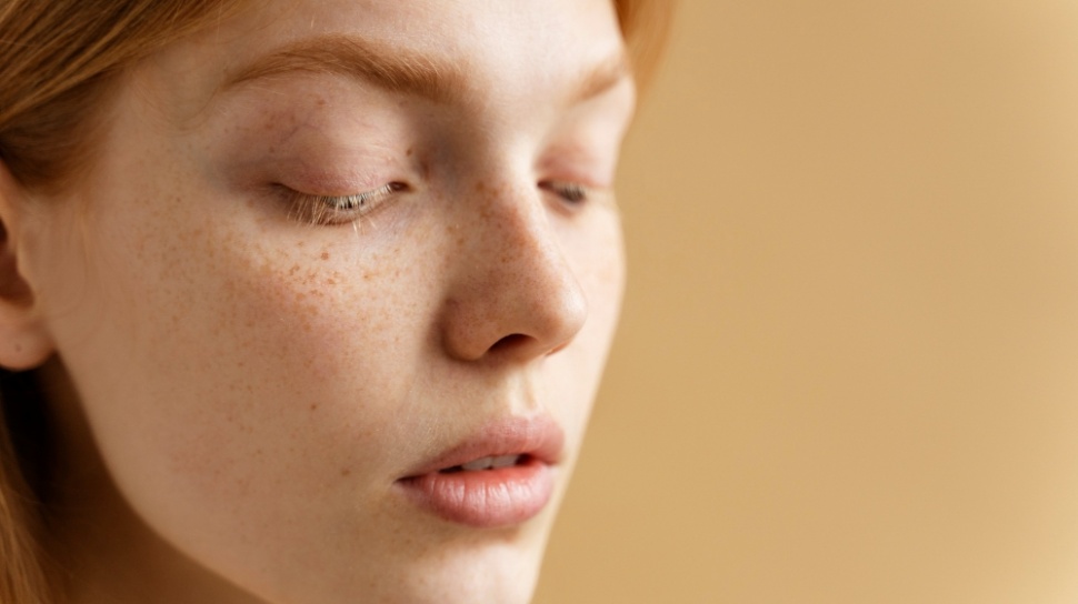 Freckles vs Sunspots vs Dark Spots: Cara Membedakan Flek dan Risikonya