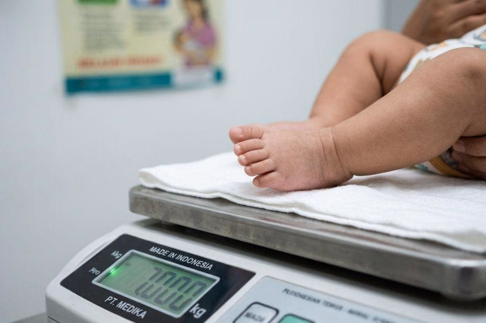 Anak Kurus Sehat atau Kekurangan Gizi? Ini Cara Membedakannya