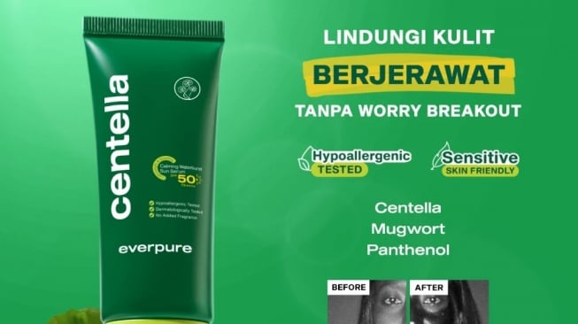 Centella Asiatica: Penyelamat Kulit Meradang dan Berjerawat