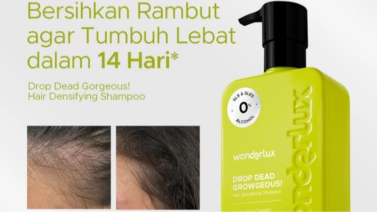 Shampo Anti Kerontokan Terbaik: Mana yang Paling Efektif?