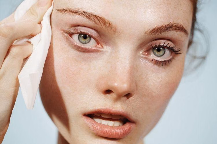 7 Tanda Skincare Tidak Cocok dan Kapan Harus Berhenti
