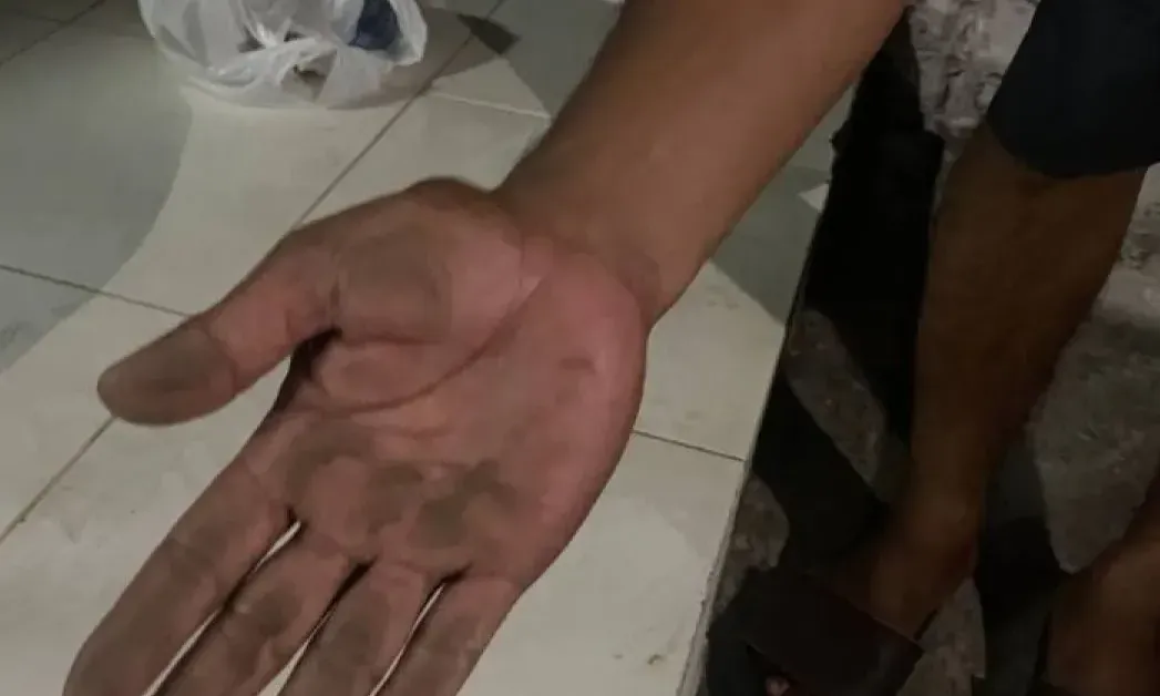 Partikel Abu Vulkanik Merusak Kulit: Lindungi dan Pulihkan Barrier Kulit