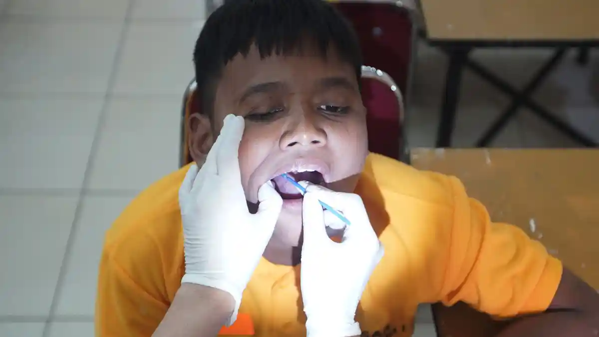 Panduan Lengkap Merawat Gigi Susu Anak Agar Bebas Karies