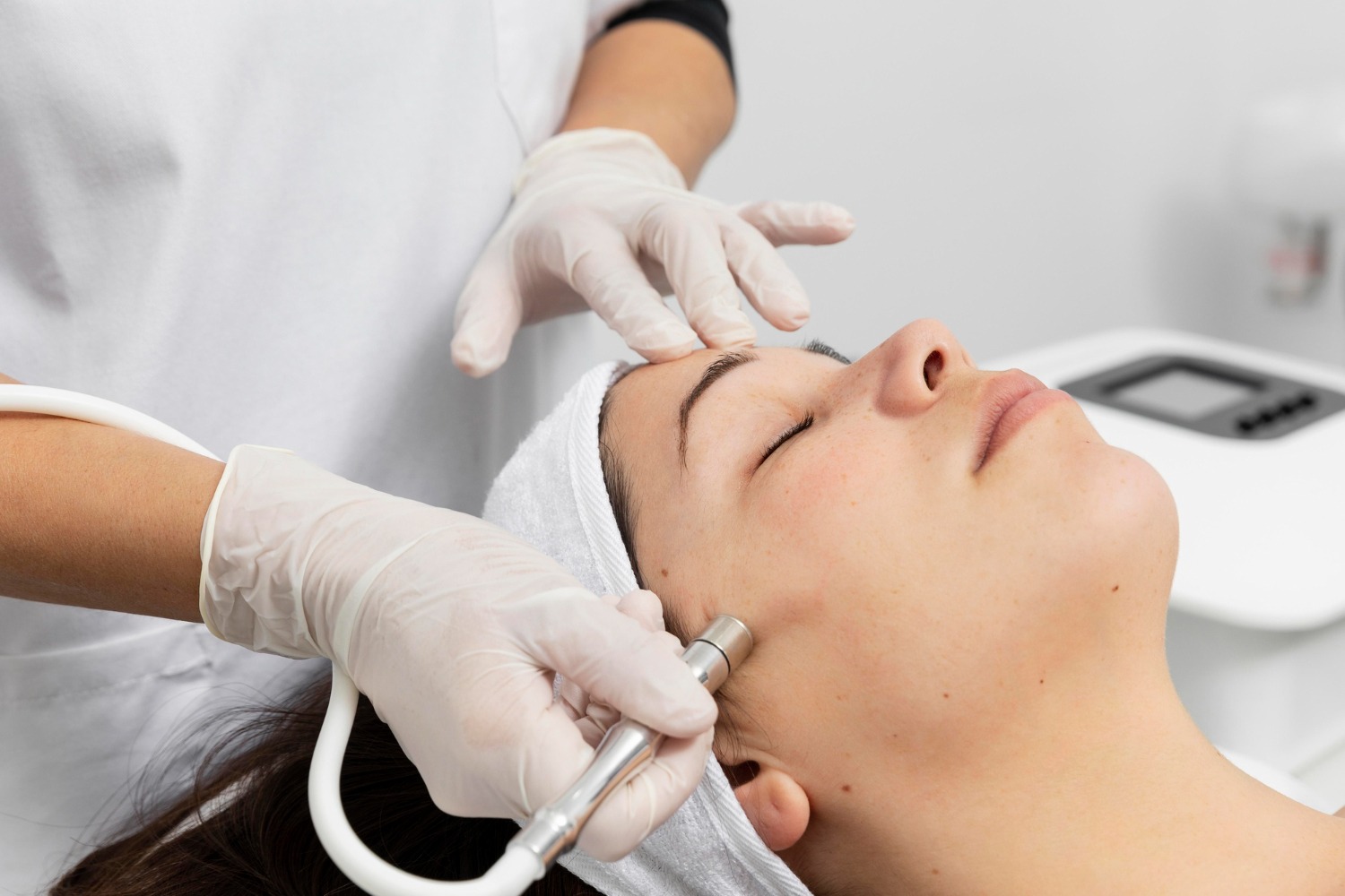 Panduan Lengkap Treatment Bekas Jerawat yang Terbukti Efektif