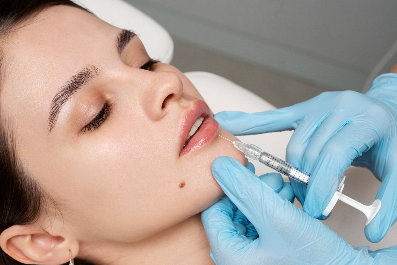 Panduan Lengkap Treatment Bekas Jerawat yang Terbukti Efektif