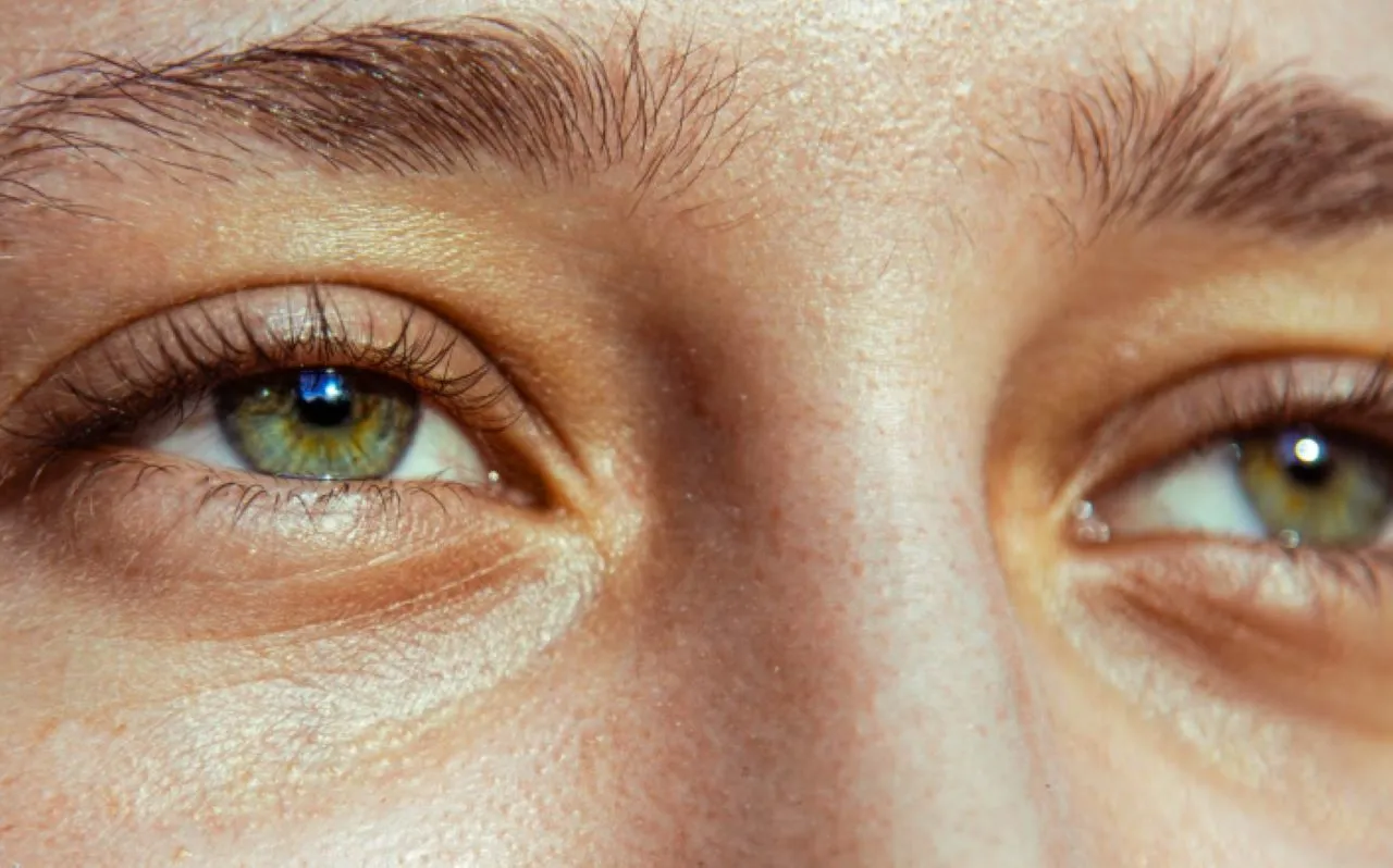 4 Eye Serum Terbaik untuk Mengatasi Kerutan dan Penuaan di Area Mata