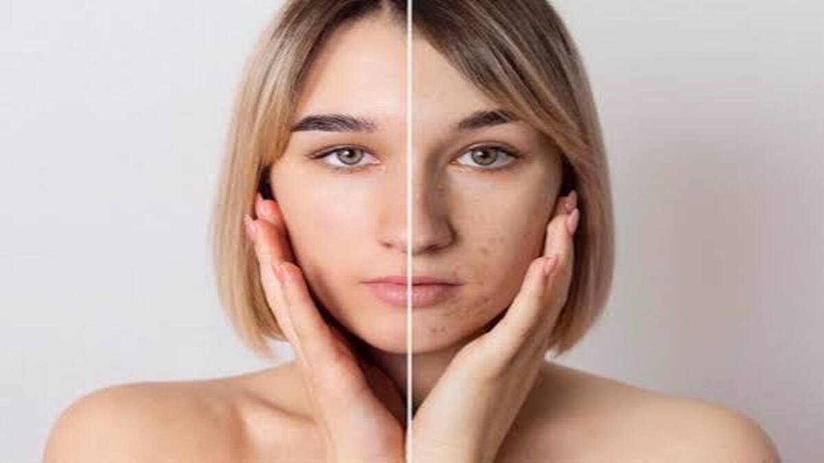 Polusi dan Sinar UV Merusak Skin Barrier: Strategi Dermatolog