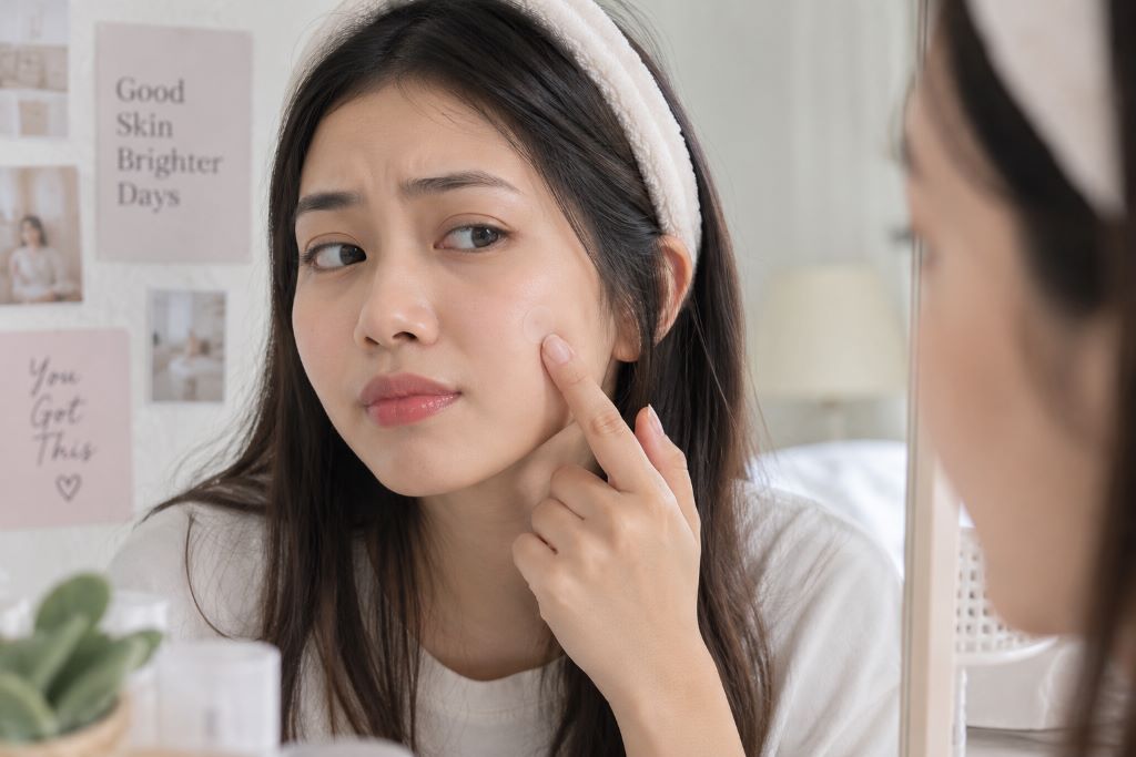 5 Invisible Acne Patch Terbaik untuk Kulit Sensitif: Tipis, Transparan, dan Aman
