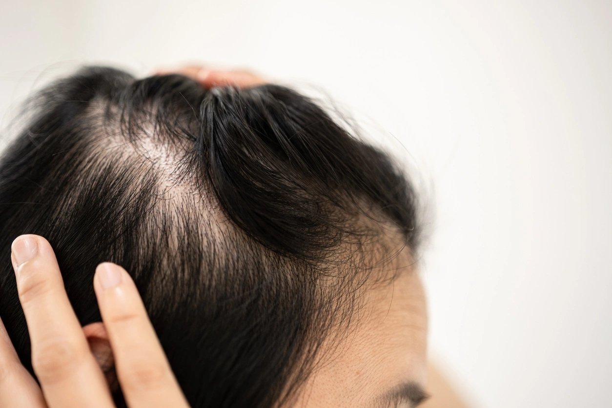 Mitos Perawatan Rambut yang Perlu Diluruskan