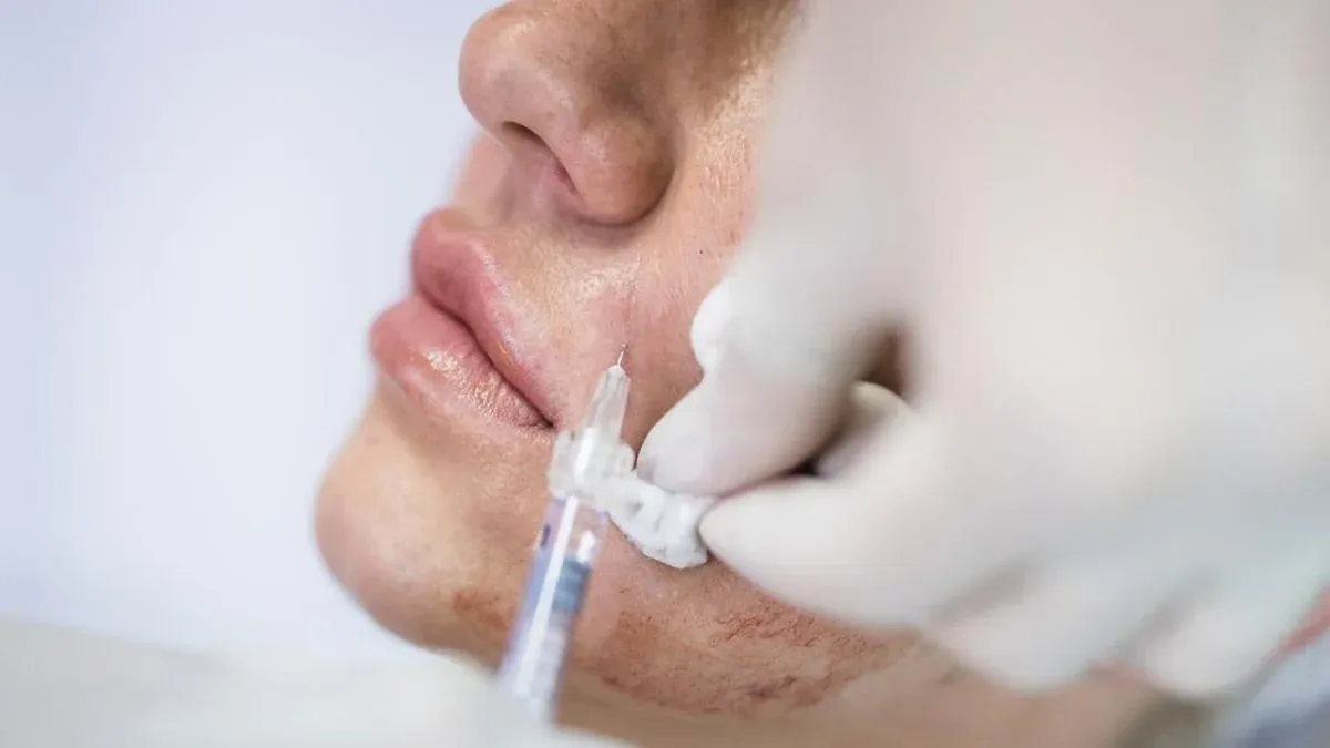Skin Booster Jaringan Donor: Medis, Legal, dan Etika yang Sering Diabaikan