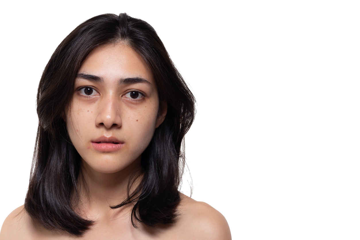 5 Bahan Alami Selain Vitamin C yang Terbukti Mencerahkan Kulit Kusam