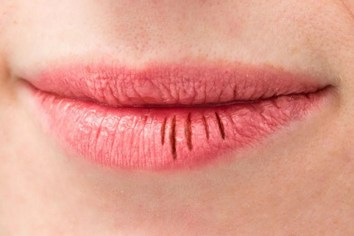 Solusi Alami untuk Mencerahkan Bibir Gelap dan Area Sensitif