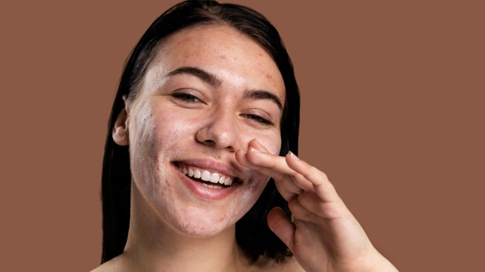 3 Kesalahan Memilih Moisturizer yang Bikin Wajah Makin Berminyak dan Berjerawat