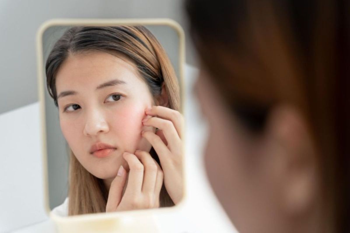 Produk Skincare Ilegal Mengancam Remaja: Wajib Cek BPOM Online