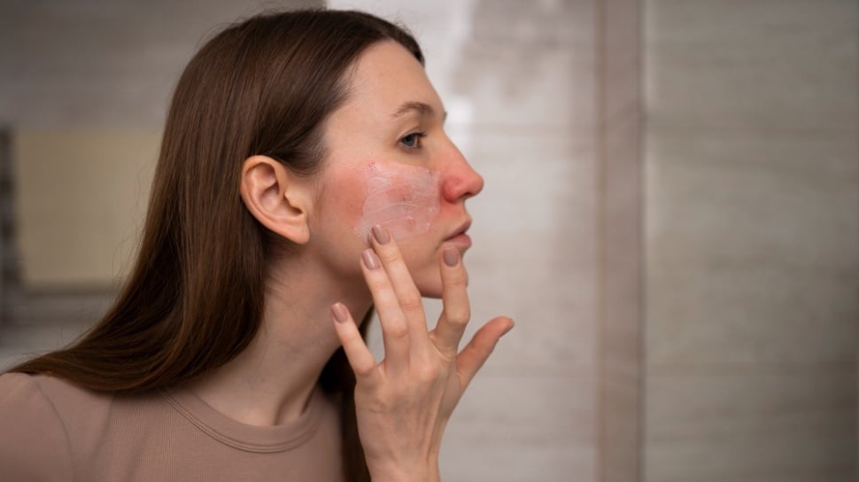 Moisturizer Lokal Terbaik untuk Kulit Berjerawat dan Berminyak