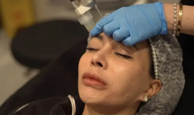 PolyPhil Skin Booster DNA Ikan Trout: Minim Downtime, Maksimal Regenerasi