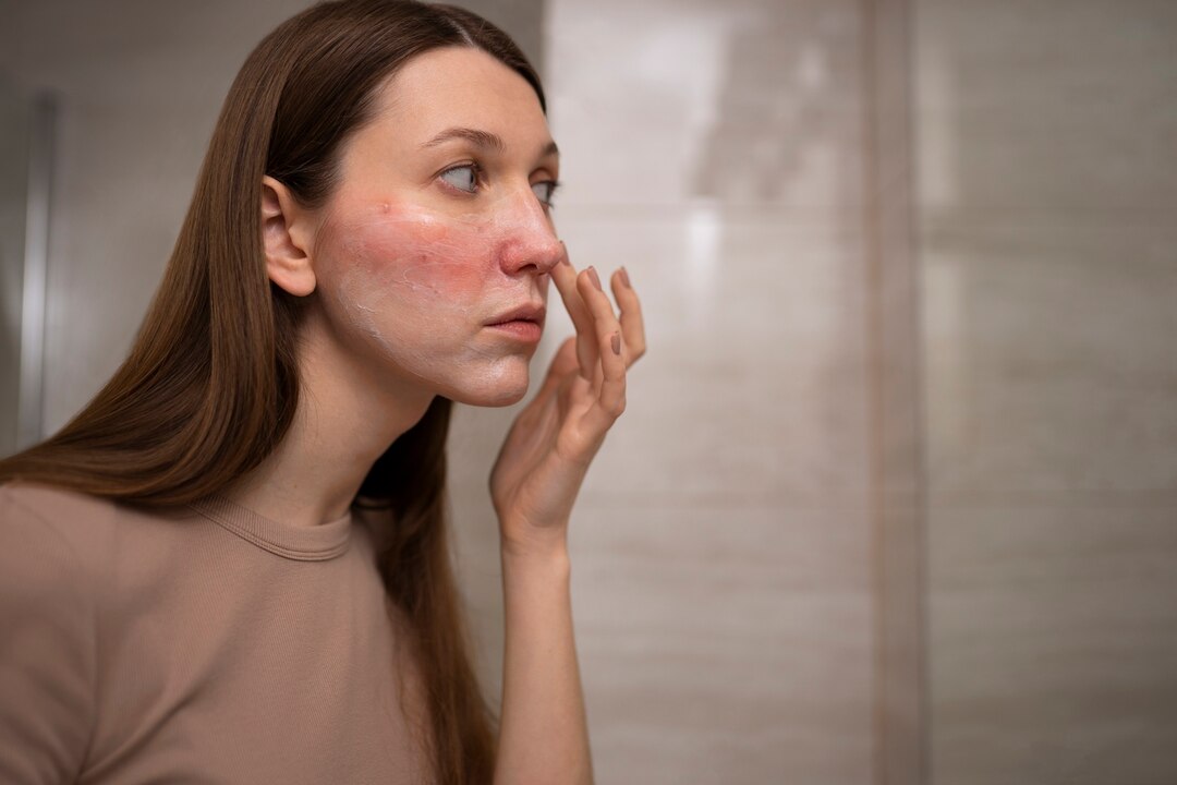 Kulit Sensitif Tiba-Tiba Perih: Cara Mengenali Pemicu dan Menyederhanakan Skincare