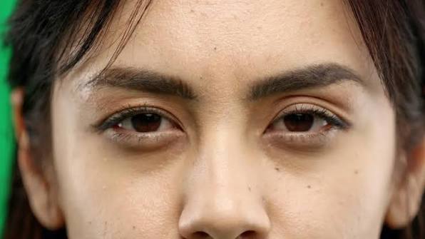 Mata Panda dan Kantung Mata: Penyebab Tersembunyi dan Solusinya