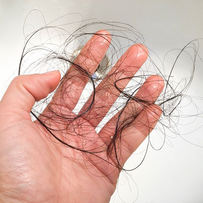 Penyebab Rambut Rontok dan Solusi Alami yang Efektif di Rumah