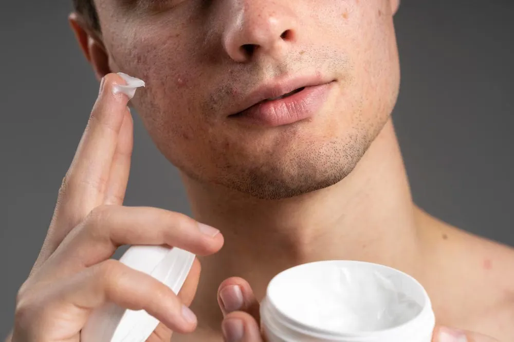 Moisturizer Lokal Terbaik untuk Kulit Berjerawat dan Berminyak