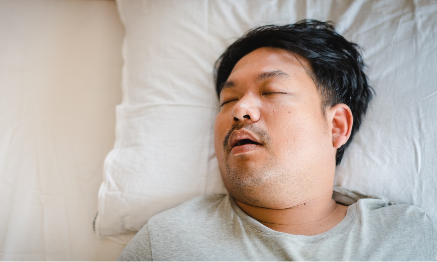 Mengorok pada Orang Obesitas: Alarm Dini Penyakit Jantung