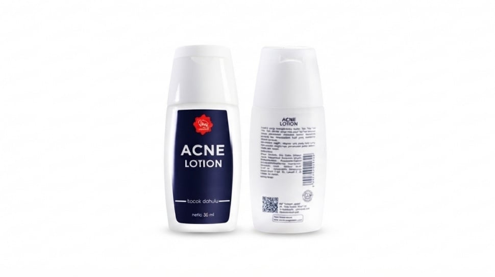 Panduan Lengkap Viva Acne Lotion: Aturan Pakai dan Manfaat