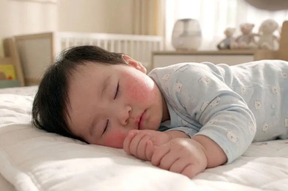 Kulit Bayi Tetap Merah Meski Popok Rutin Diganti