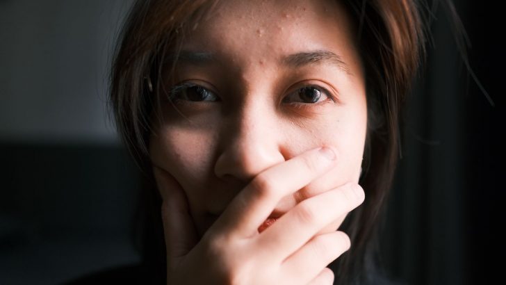 Jenis Bekas Jerawat dan Cara Mengatasinya Sesuai Kondisi Kulit
