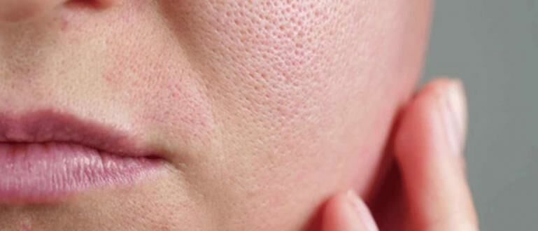 Skin Prep Sempurna untuk Pori Besar agar Makeup Flawless Seharian