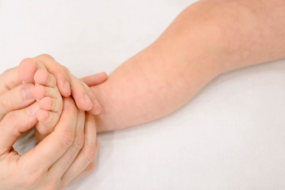 Membedakan Campak dan Influenza A pada Bayi