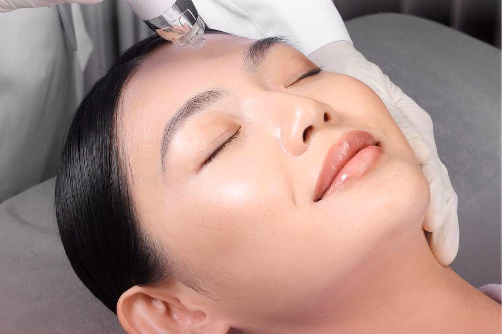 DNA Salmon dan PDRN: Bahan Ajaib Baru untuk Treatment Kulit Glowing