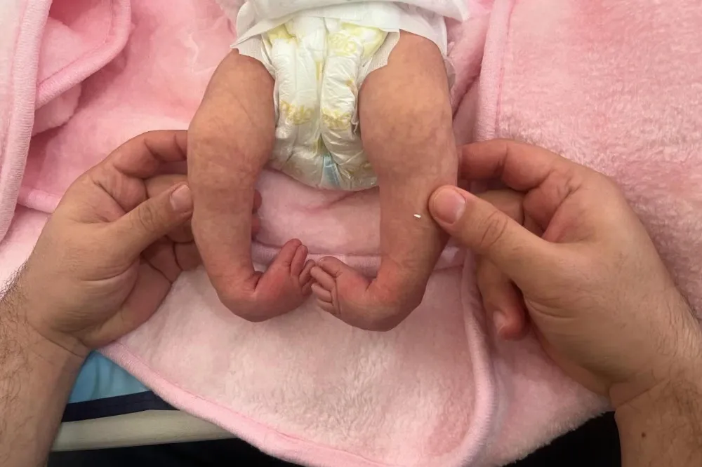 Kelainan Bawaan pada Bayi: Tanda Dini dan Pilihan Penanganan