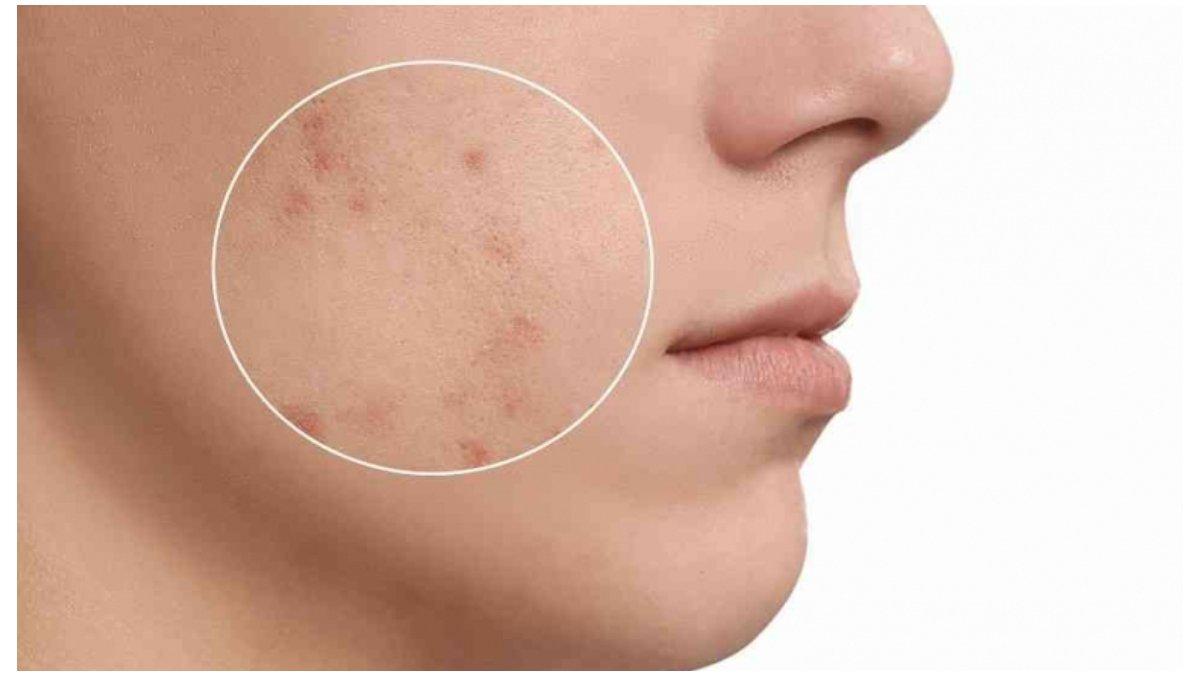 Rutinitas Skincare Malam untuk Menyamarkan Flek Hitam