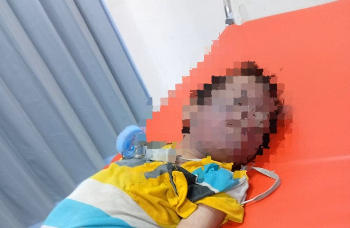 Melindungi Anak Down Syndrome dari Perundungan di Rumah dan Sekolah