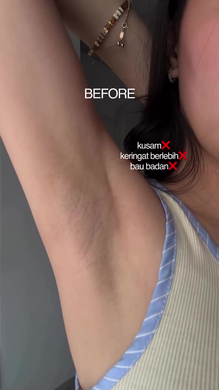 Close-up ketiak yang diangkat dengan catatan masalah: kusam, keringat berlebih, dan bau badan