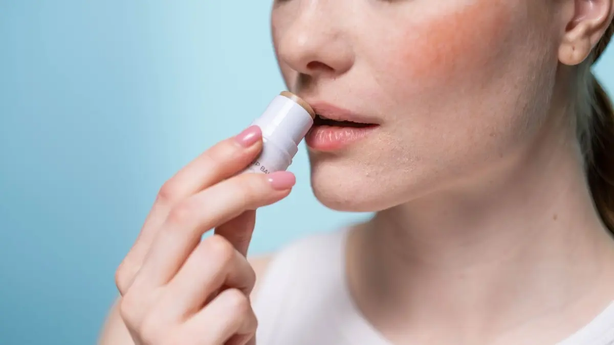 7 Penyebab Bibir Kering Mengelupas dan Cara Merawatnya