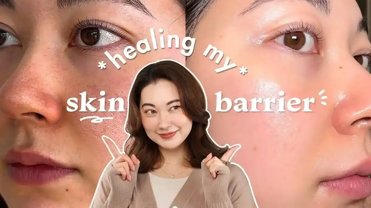 Rutinitas 7 Hari Memperbaiki Skin Barrier yang Rusak