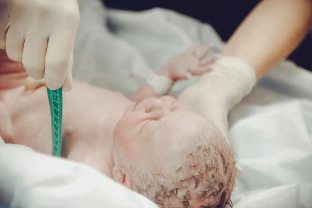 Rambut Halus Bayi Baru Lahir: Normal, Kapan Perlu Waspada?